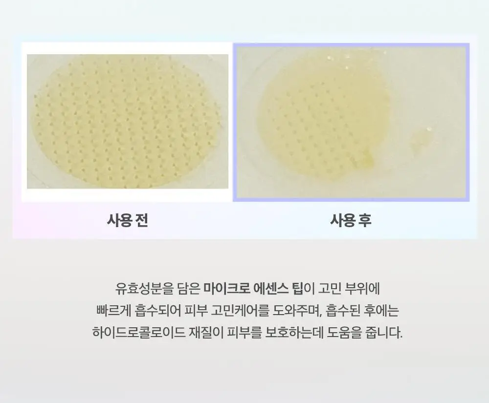[6일기미패치/잡티케어] 휴캄 나이아신 비타 C 기미 잡티 순백 패치 (6매입) 상세페이지 8
